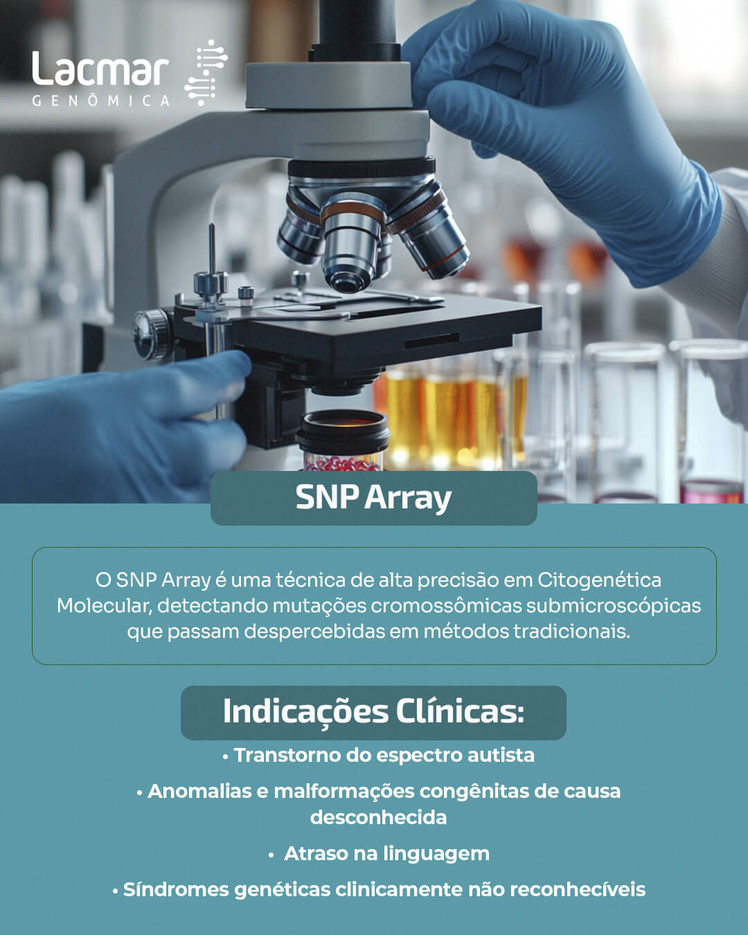 Exame SNP Array - Lacmar Genômica